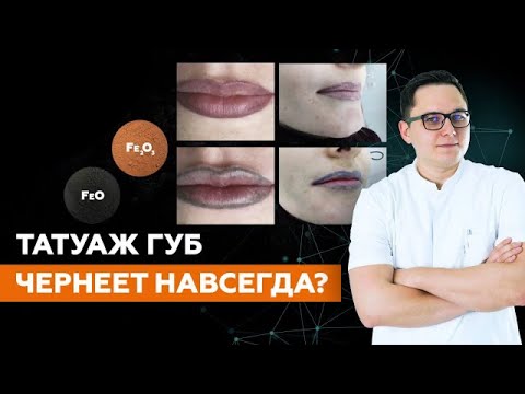 Видео: Почему татуаж губ чернеет после воздействия лазера?