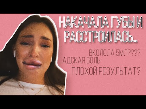 Видео: Я накачала губы… // Vlog #5