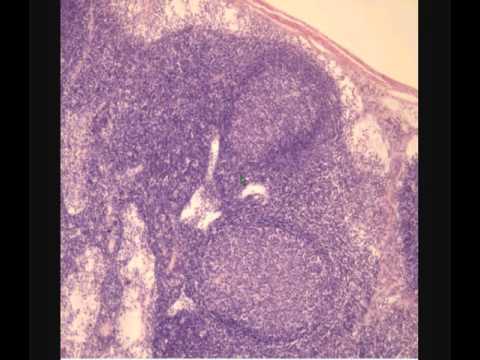 Видео: ЛИМФАТИЧЕСКИЙ УЗЕЛ. Lymph node. СРЕЗ В СВЕТОВОЙ МИКРОСКОП.