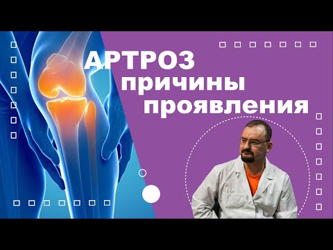 Видео: Артроз сустава - постарение. Причины и проявления артроза.