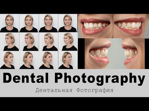 Видео: Дентальный фотопротокол. #dentalphotography #дентальнаяфотография