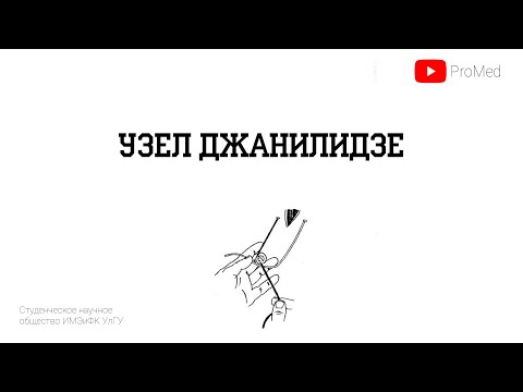 Видео: Узел Джанелидзе