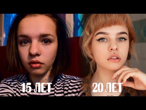 Видео: КАК Я ИЗМЕНИЛАСЬ? РИНОПЛАСТИКА?! Фото, которых нигде нет
