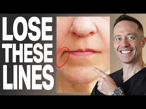 Видео: ПРАВДА о филлерах для коррекции морщин марионетки (руководство врача)
