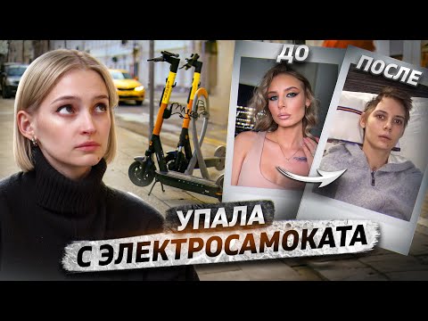 Видео: Упала с электросамоката и стала инвалидом