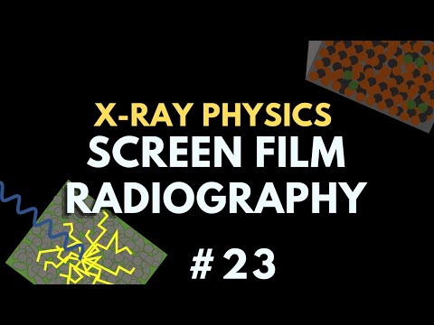 Видео: Экранная рентгенография | Физика рентгеновских лучей | Курс физики радиологии № 30
