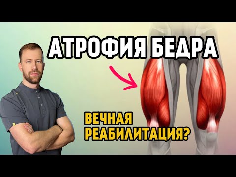 Видео: Резекция медиального мениска + разрыв латерального! ПОЖИЗНЕННАЯ РЕАБИЛИТАЦИЯ? АТРОФИЯ! Что делать?