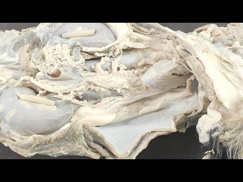 Видео: Мочевые органы