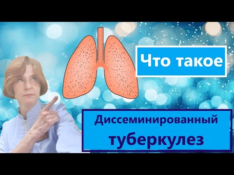Видео: Диссеминированный туберкулез
