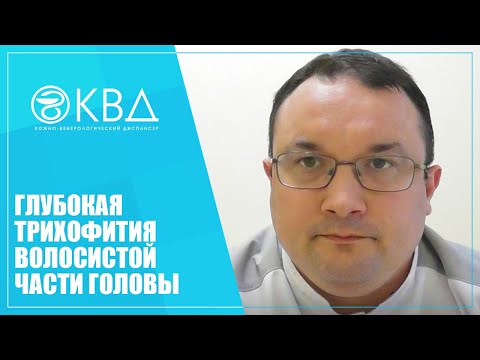 Видео: 1160  Глубокая трихофития волосистой части головы