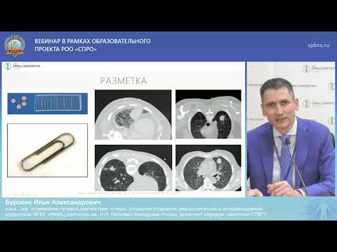 Видео: Вебинар «Компьютерная томография в онкологической практике»