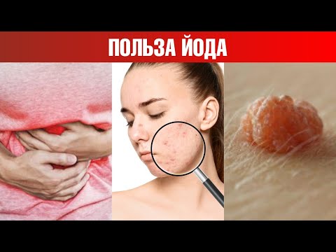 Видео: Как определить дефицит йода дома? 🧐 Польза йода