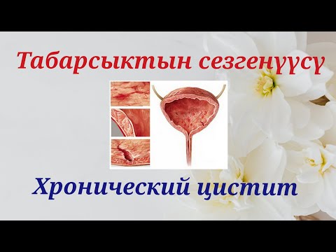 Видео: ТАБАРСЫКТЫН СЕЗГЕНҮҮСҮ | ЦИСТИТ