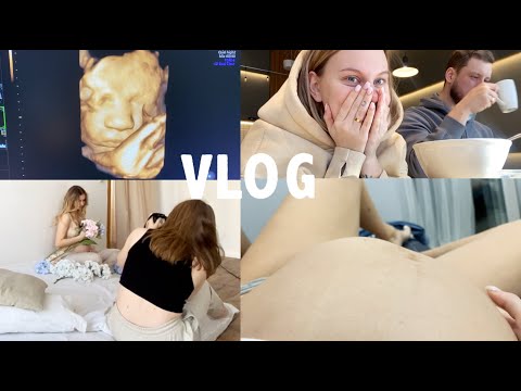 Видео: ДНЕВНИК БЕРЕМЕНЯШКИ: Третий Скрининг / Фотосессия В Белье