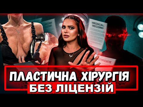 Видео: ВСЕ ГІРШЕ НІЖ ЗДАВАЛОСЬ: Яку Страшну Правду Приховують Хірурги?! частина 2