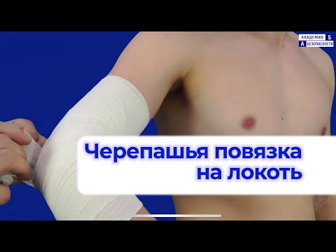 Видео: Наложение черепашьей расходящейся повязки на локтевом суставе