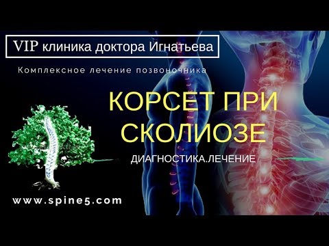 Видео: Корсет при сколиозе. Носить или нет?! Нужен ли корсет шено