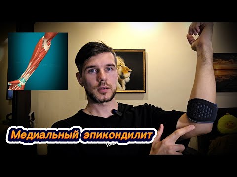 Видео: У меня медиальный эпикондилит. Что делать?