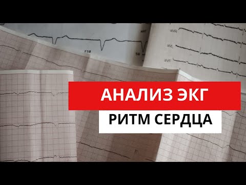 Видео: Анализ ЭКГ. Определение ритма сердца. Норма и патология на ЭКГ.