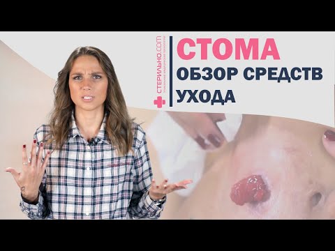 Видео: Обзор средств по уходу за кишечной стомой   | Стерильно.com