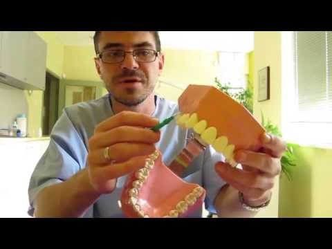 Видео: Интердентални четки