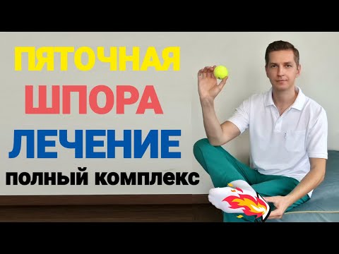 Видео: ПЯТОЧНАЯ ШПОРА. ЛЕЧЕНИЕ В ДОМАШНИХ УСЛОВИЯХ. ПОЛНЫЙ КОМПЛЕКС.