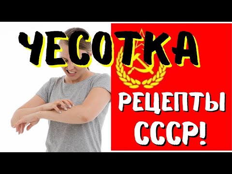 Видео: КОПЕЕЧНЫЕ РЕЦЕПТЫ из СССР от ЧЕСОТКИ!  100% РАБОТАЕТ
