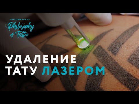 Видео: УДАЛЕНИЕ ТАТУИРОВКИ ЛАЗЕРОМ | ВСЁ О ЛАЗЕРНОМ УДАЛЕНИИ