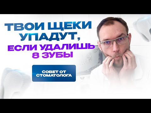 Видео: Твои щеки упадут, если ты удалишь 8 зубы (зубы мудрости). Стоматолог Стас Белоус