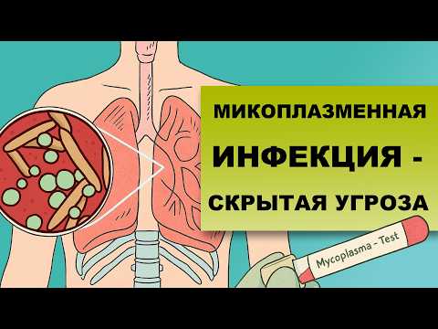Видео: МИКОПЛАЗМЕННАЯ ПНЕВМОНИЯ: ПОЧЕМУ ЕЁ СЛОЖНО ВЫЯВИТЬ?
