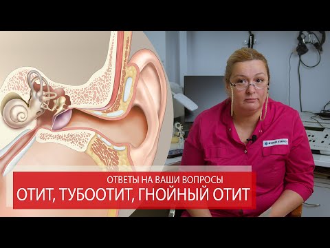 Видео: ОТИТ, ТУБООТИТ, ГНОЙНЫЙ СРЕДНИЙ ОТИТ | Ответы на ваши вопросы.