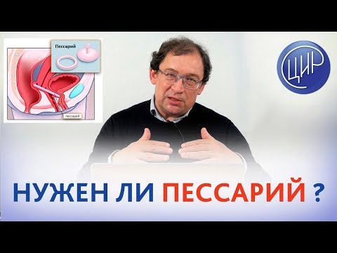 Видео: Пессарий. НАДО ли УСТАНАВЛИВАТЬ ПЕССАРИЙ, если шейка матки 31 миллиметр?