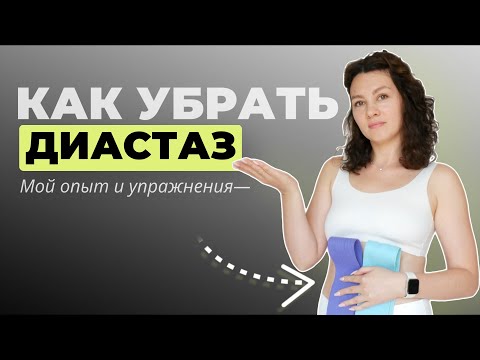 Видео: Живот как беременный-ЭТО ДИАСТАЗ