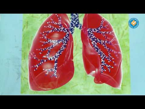 Видео: Кашлица - видове кашлица и причини