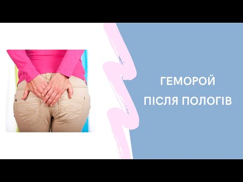 Видео: Геморой під час вагітності та після. Як боротись з гемороєм.