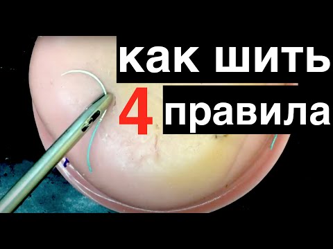 Видео: 4 правила шитья в лапароскопии //лапароскопический шов //Laparoscopic suturing rules
