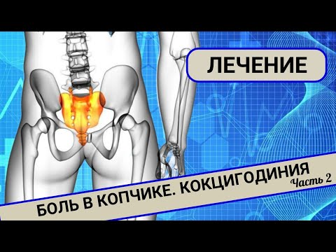 Видео: БОЛИТ КОПЧИК. Кокцигодиния. Лечение. (Часть 2)