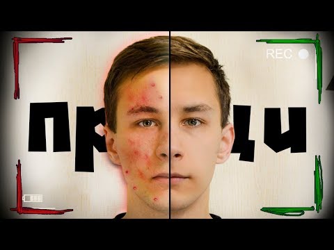 Видео: Делай ЭТО и ПРЫЩИ УЙДУТ!!!