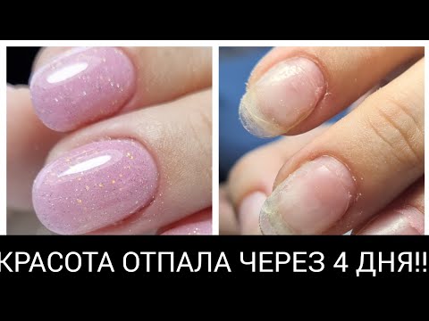 Видео: МЕГА ОШИБКА при работе с ГЕЛЕВЫМИ ТИПСАМИ