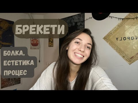 Видео: Брекети и доста неща около тях 🦷
