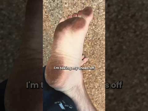 Видео: Я буду ходить босиком 10 дней — без обуви, без исключений 👣