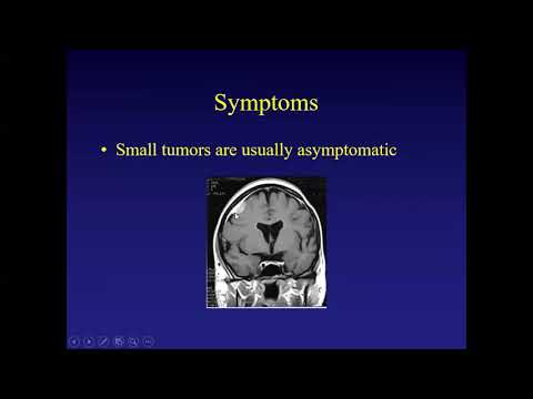 Видео: Какие менингиомы не следует лечить
