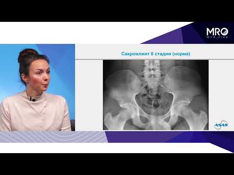 Видео: 2 2 4 Рентгенодиагностика на примере клинических случаев скелет в шкафу и ответы на вопросы из чата