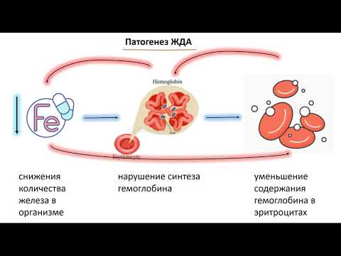 Видео: железодефицитная анемия | определение, этиология, патогенез, клиника, диагностика, лечение