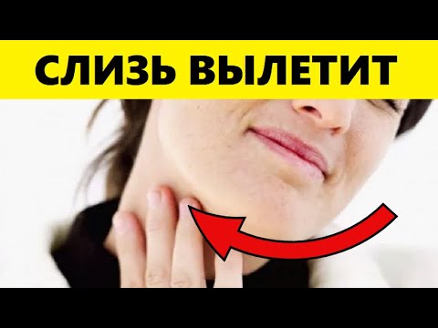 Видео: Слизь Из Горла Вылетит! Вот Как Спасти Лёгкие и Горло От Мокроты и Слизи Обычными Методами...