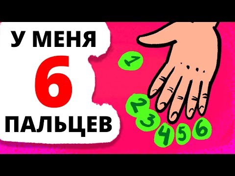 Видео: У меня гексадактилия, поэтому на моей руке 6 пальцев