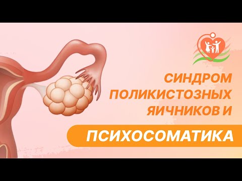 Видео: 🔎 Синдром поликистозных яичников и психосоматика