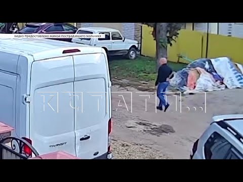 Видео: Мужчина по ошибке избил чужого ребенка дубиной до некроза кости