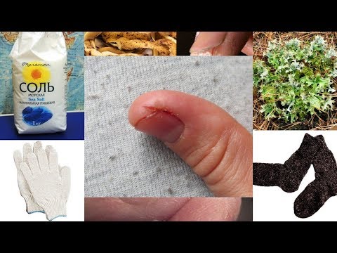 Видео: Трещины 💥 на пальцах 🖐 рук. Холодовой дерматит (dermatitis).