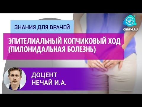 Видео: Профессор Нечай И.А.: Эпителиальный копчиковый ход (пилонидальная болезнь)